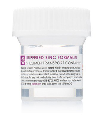 Picture of Prefilled Formalin Container StatClick™ Polypropylene 60 mL Fill in 120 mL (4 oz.) Screw Cap Warning Label NonSterileBFZ0460