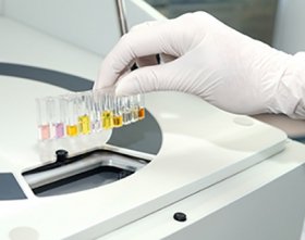 Picture of Reagent General Chemistry Alkaline Phosphatase R1: 1 X 500 mL, R2: 1 X 125 mLA7516625