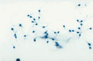 Picture of SLIDE HUMAN SPERM93V7241