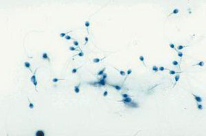 Picture of SLIDE HUMAN SPERM93V7241