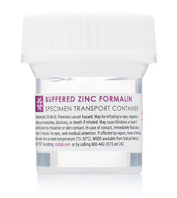 Picture of Prefilled Formalin Container StatClick™ Polypropylene 20 mL Fill in 40 mL (1.35 oz.) Screw Cap Warning Label NonSterileBFZ0115