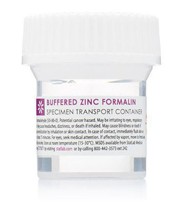 Picture of Prefilled Formalin Container StatClick™ Polypropylene 20 mL Fill in 40 mL (1.35 oz.) Screw Cap Warning Label NonSterileBFZ0115