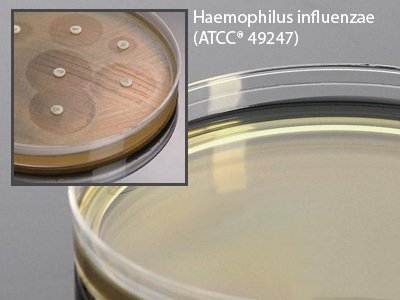 Picture of Haemophilus Test Medium Agar 15 X 150 mm For Susceptibility TestingH07