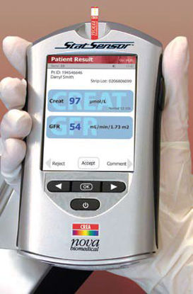 Picture of Reagent Test Strip StatSensor® General Chemistry Creatinine For StatSensor Creatinine Meter 50 X 25 Strips 25 StripsCIA1060774