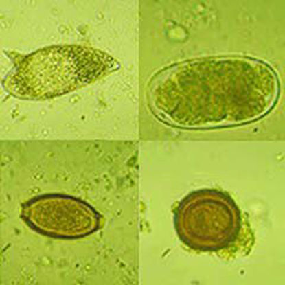 Picture of Teaching Microscope Slide Protozoa Stained 1 X 3 Inch4918