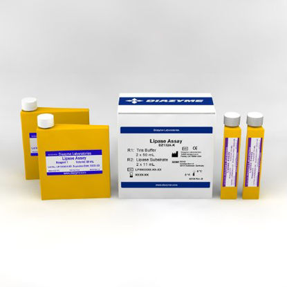 Picture of Reagent Kit General Chemistry Lipase For Clinical Chemistry Systems R1: 2 X 50 mL / R2: 2 X 11 mLDZ132A-K