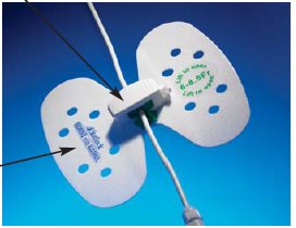 Picture of Stabilization Device StatLock®VUPD1214