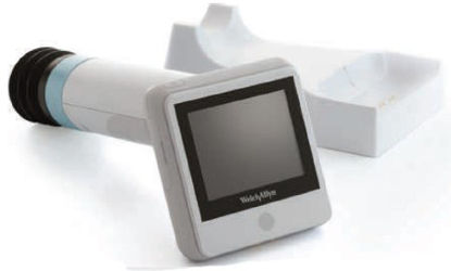 Picture of Diabetic Retinopathy Imager RetinaVue®RV100-B