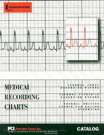 Picture of Diagnostic Recording Paper Philips Thermal Paper 50 mm X 100 Foot Roll Black Grid9270-0980