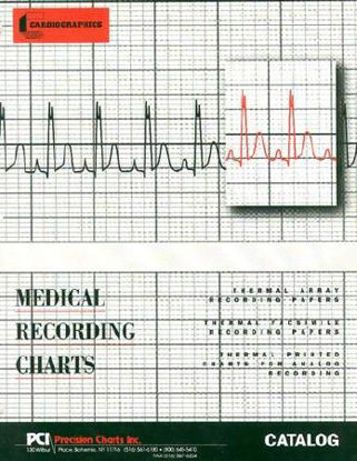 Picture of Diagnostic Recording Paper Philips Thermal Paper 50 mm X 100 Foot Roll Black Grid9270-0980
