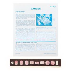 Picture of SLIDE CANCER SET7970467
