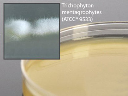 Picture of Prepared Media Inhibitory Mold Agar with Chloramphenicol Deep Fill Plate FormatW58