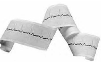 Picture of Diagnostic Recording Paper Thermal Paper 50 mm X 100 Foot Roll Without Grid3579426