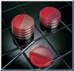 Picture of Prepared Media BD BBL™ Rose Bengal Agar with Penicillinas Pink Rodac™ Plate Format292225