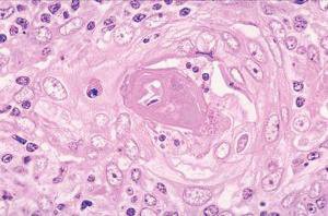 Picture of Teaching Microscope Slide Thymus 1 X 3 Inch964122