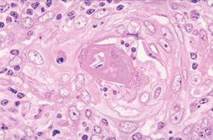 Picture of Teaching Microscope Slide Thymus 1 X 3 Inch964122