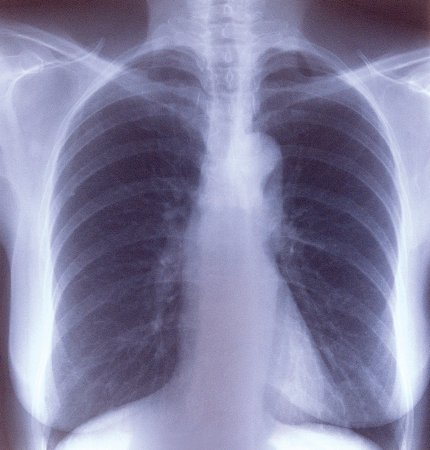 Picture of X-Ray Film Clear Choice™ Performance 10 X 12 Inch Medium Speed Green Sensitive LatitudeEA4NC