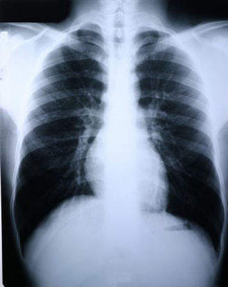 Picture of X-Ray Film Clear Choice™ Performance 11 X 14 Inch High Speed Blue Sensitive High58K2R