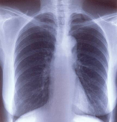 Picture of X-Ray Film Clear Choice™ Performance 8 X 10 Inch Half Speed Green Sensitive HighEK8FL