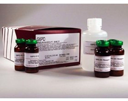 Picture of Reagent General Chemistry Glucose R1: 10 X 6 mL, R2: 1 X 120 mLG7583180