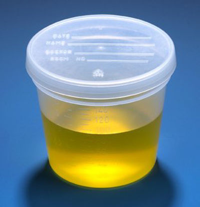Picture of Specimen Container 2-1/4 X 2-7/8 Inch Polypropylene 150 mL (5 oz.) Snap-On Lid Patient Information NonSterile5917