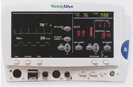 Picture of ECG Snap Electrode Welch Allyn® Monitoring Non-Radiolucent 30 per Pack6200-11