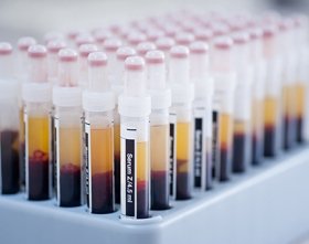 Picture of Reagent Hepatic / General Chemistry Aspartate Aminotransferase (AST) 1 X 500 mLA7561625