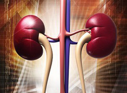 Picture of Reagent Renal / General Chemistry Creatinine For Mindray™ BS-480 Analyzer 4 X 40 mL14-C7548-216