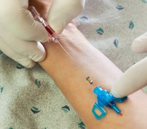 Picture of Closed IV Catheter Introcan Safety® 3 22 Gauge 1 Inch Sliding Safety Needle4251128-02