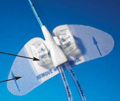 Picture of Stabilization Device Statlock® PICC PlusPIC0220