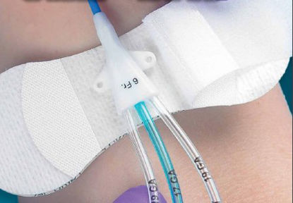 Picture of Universal Securement Device Grip-Lok®3200S