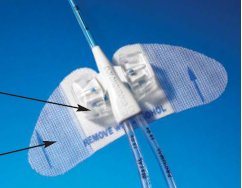 Picture of Central Venous Catheter Stabilization Device Statlock® PICC PlusVPPPSP