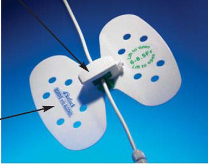 Picture of Universal Plus Stabilization Device StatlockVUPD68