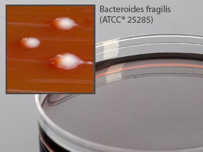 Picture of Prepared Media LKV (Laked Sheep Blood, Kanamycin, Vancomycin) Agar Mono-Plate FormatA60