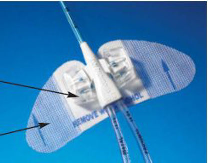 Picture of Central Venous Catheter Stabilization Device Statlock® PICC PlusVCDC