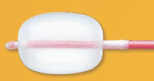 Picture of Embolectomy Catheter Fogarty® 4 Fr. 40 cm120404F