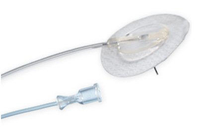 Picture of Subcutaneous Infusion Set Neria™ 29 Gauge 6 mm 42 Inch TubingPP1102936N