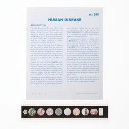 Picture of SLIDE HUMAN DISEASE7970338