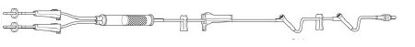 Picture of Primary Administration Set Interlink® 10 Drops / mL Drip Rate 100 Inch Tubing 2 Ports2C6714