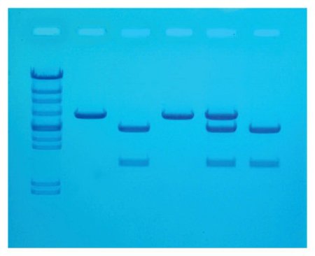 Picture of Cholesterol Diagnostics Educational Kit Edvotek™ 8 gels, RefrigeratedS94608