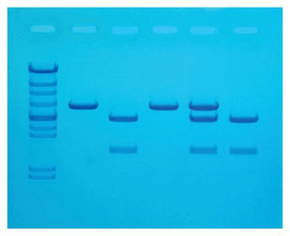 Picture of Cholesterol Diagnostics Educational Kit Edvotek™ 8 gels, RefrigeratedS94608