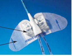 Picture of Central Venous Catheter Stabilization Device Statlock®VFS