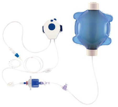 Picture of Pain Pump Ambu® Action™ 400 mL Capacity 1 to 6 mL / Hr. Flow Rate418108400