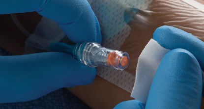 Picture of Extension Set NeutraClear™ Tri-fuse 5.5 Inch Tubing 0.7 mL Priming VolumePY-NC5316