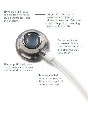 Picture of Implantable Port 8 Fr. Single Lumen0605320