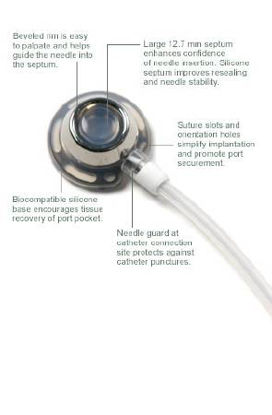 Picture of Implantable Port 8 Fr. Single Lumen0605320