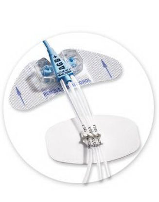 Picture of Stabilization Device StatLock®CV0223