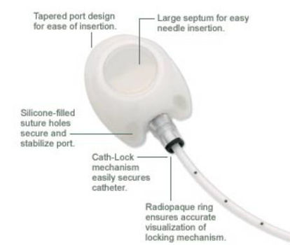 Picture of MRI Implantable Port X-Port Isp™ 9.6 Fr. Single Lumen0607555