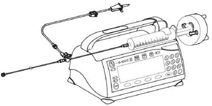 Picture of Administration Set Medfusion™ 67 Inch Tubing 2.6 mL Priming VolumeMX448L60MG