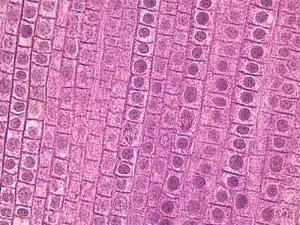 Picture of SLIDE FISH/ONION MITOSIS93V2243